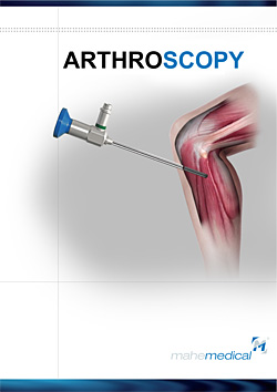 Arthroscopy
