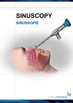 Sinuscopy